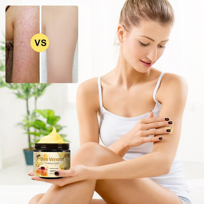HOUKEA™Bee Venom Cream (Original)