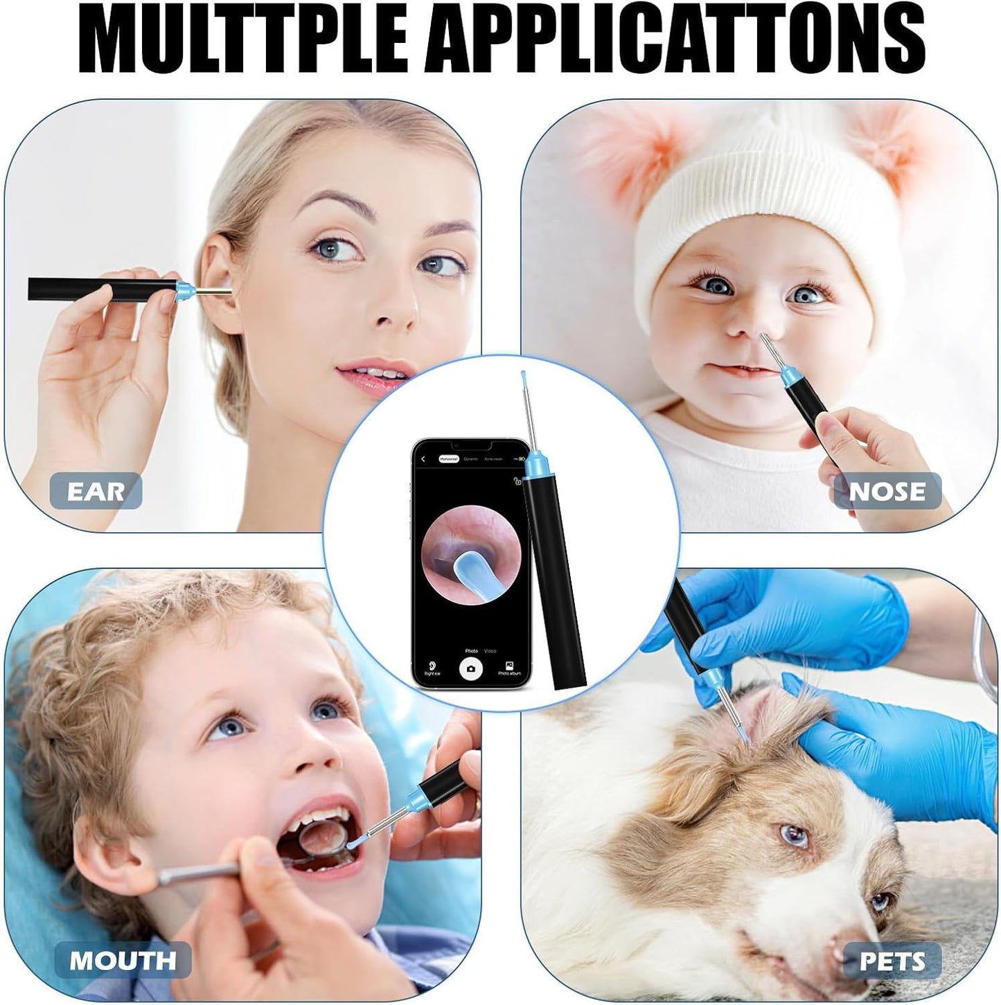 Smart Visual Ear Cleaner