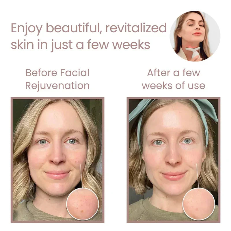 Get Parcel™ Facial Rejuvenation Device , Beauty Facial Massager,Wavy Chic Beauty Microcurrent Facial Device Hot Selling Product