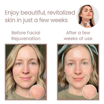 Get Parcel™ Facial Rejuvenation Device , Beauty Facial Massager,Wavy Chic Beauty Microcurrent Facial Device Hot Selling Product
