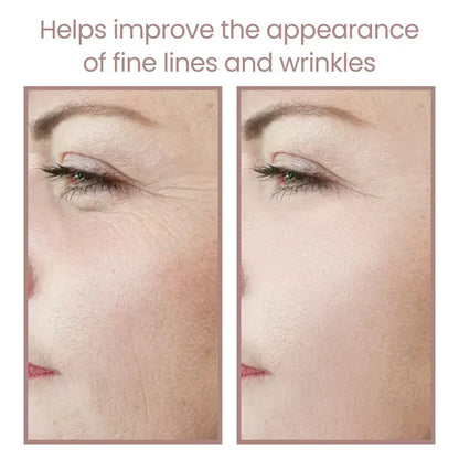 Get Parcel™ Facial Rejuvenation Device , Beauty Facial Massager,Wavy Chic Beauty Microcurrent Facial Device Hot Selling Product