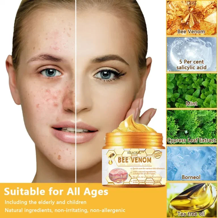 HOUKEA™Bee Venom Cream (Original)